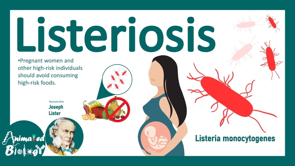 What is Listeriosis? Morelia Medical Clinic